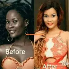6=U.K.S=@@+27695222391 BUY TINAH BEST skin #lightening cream, Dark Spots/ Stretch Marks. pills, inje