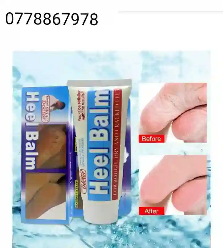 Heel balm for sale in Harare