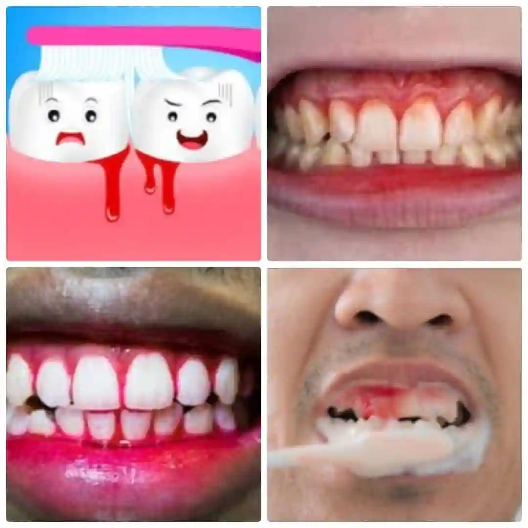 teeth care package 263787615081 