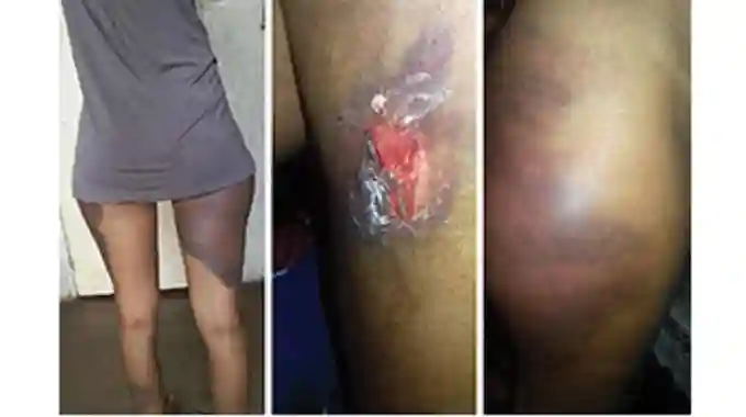 2 Bulawayo Sisters Who Were Assaulted By The Police Identify Alleged Assailants During A Parade