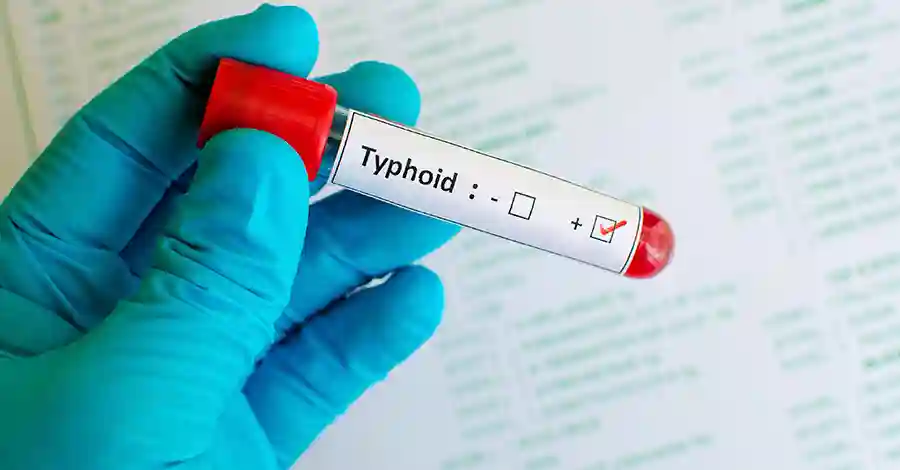 Glen View Hit By Typhoid Outbreak