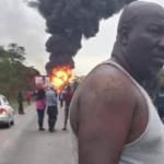 Man Burnt While Retrieving Victims Of Harare-Mutare Highway Accident
