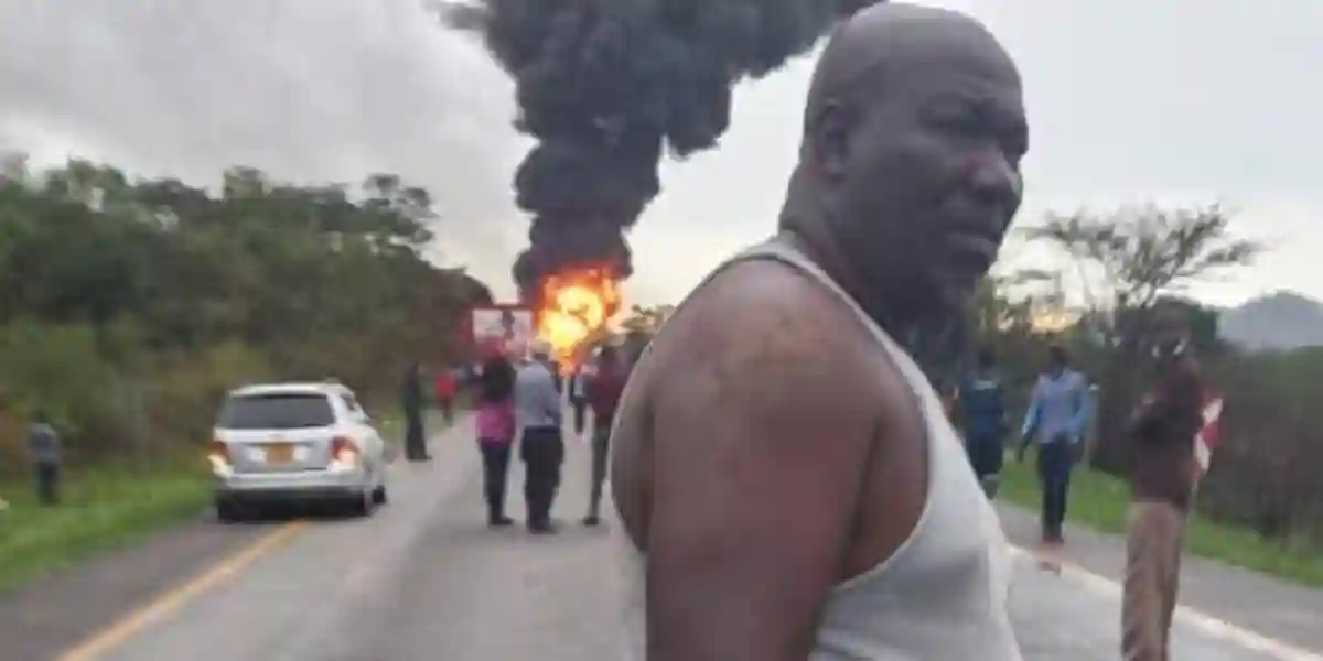 Man Burnt While Retrieving Victims Of Harare-Mutare Highway Accident