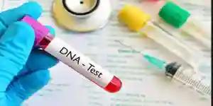 Olinda Chapel Pays DNA Test Bill For Livingstone's Presumed Remains
