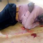 PICTURES: MDC Alliance Activists Attacked In Zvimba