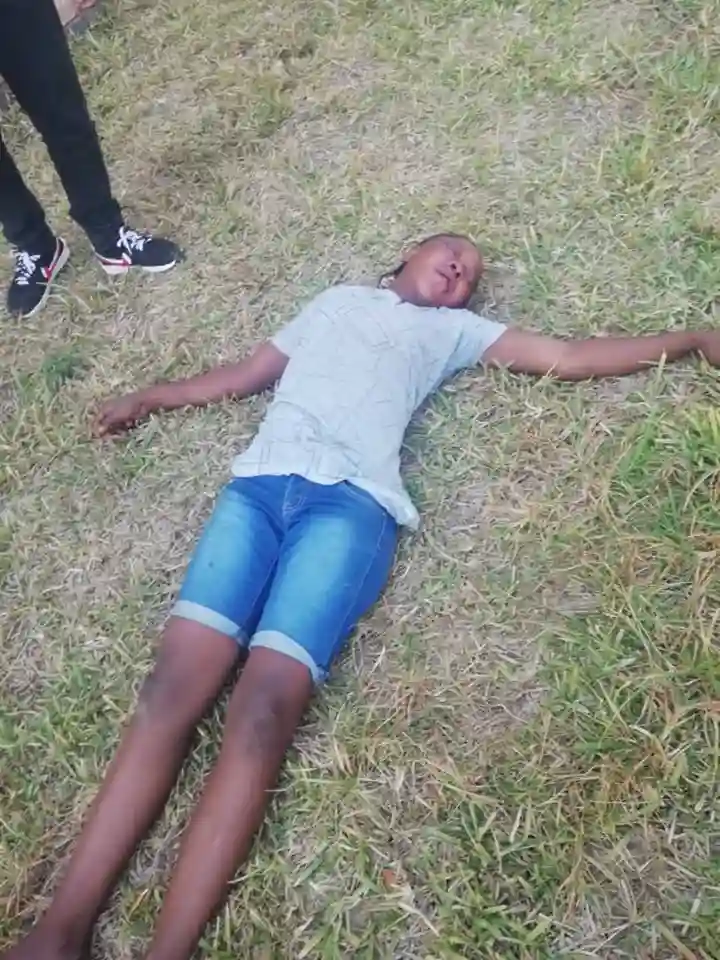 PICTURES: MDC Youth Leader Attacked By ZANU PF Youths In Kwekwe - Report