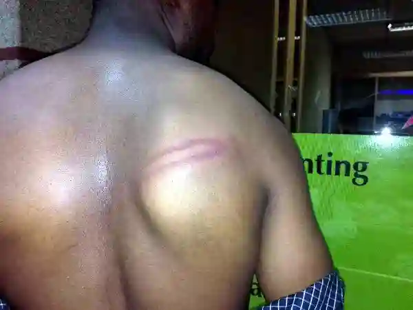 Police Assault Journalist in Harare City Centre