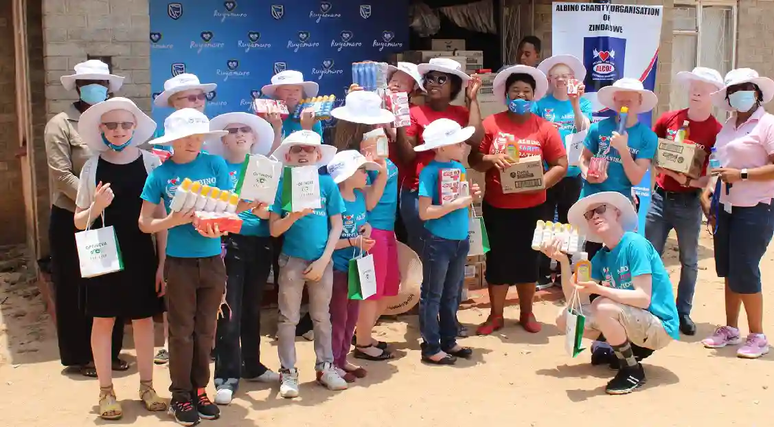 Stanbic Donates US$34k Worth Products To People With Albinism