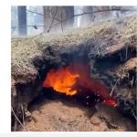 UPDATE: Hwange Girl Who Was Burnt By Underground Fire Dies