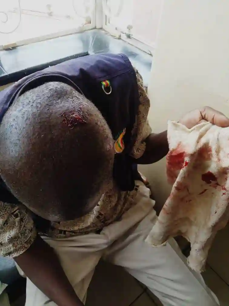 WATCH: "3rd Force" Brutalising Journalists In Harare