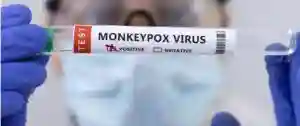 Zimbabwe Cabinet Adopts Precautionary Measures Against Monkeypox